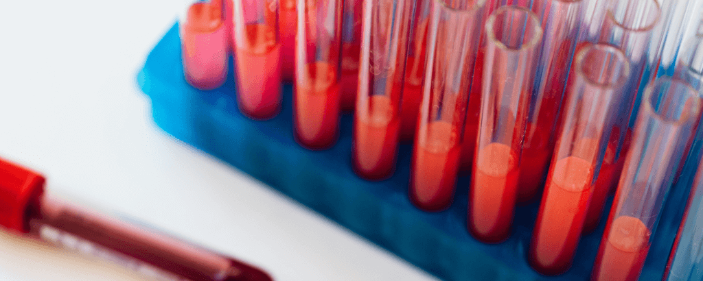 dislipidemias e plano alimentar